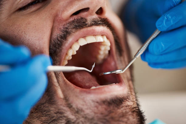 Laser Dentistry in Sunriver, OR